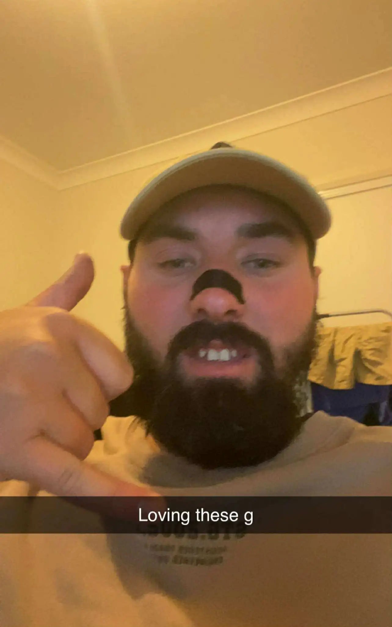 aussie-bloke-wearing-4k-nasal-strips.webp__PID:46db222d-2aae-4cf1-9495-d422bc2ce27f